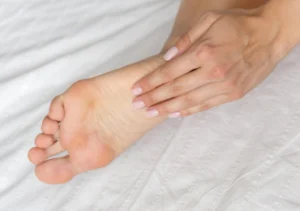 rxsurgicals-what-are-callus-and-corns