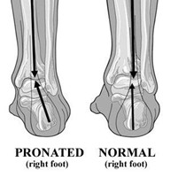 your-inner-ankle-bone-the-talus-is-sticking-out