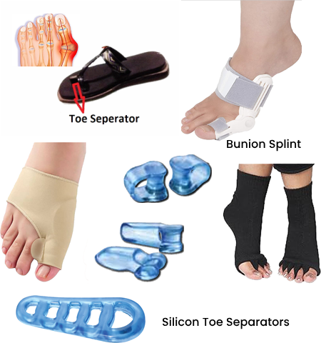 rxsurgicals-bunion-hallux-valgus-img