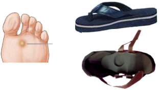 rxsurgicals-corns-and-calluses