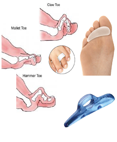 rxsurgicals-hammer-toe