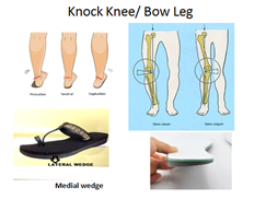 rxsurgicals-pronation-supination